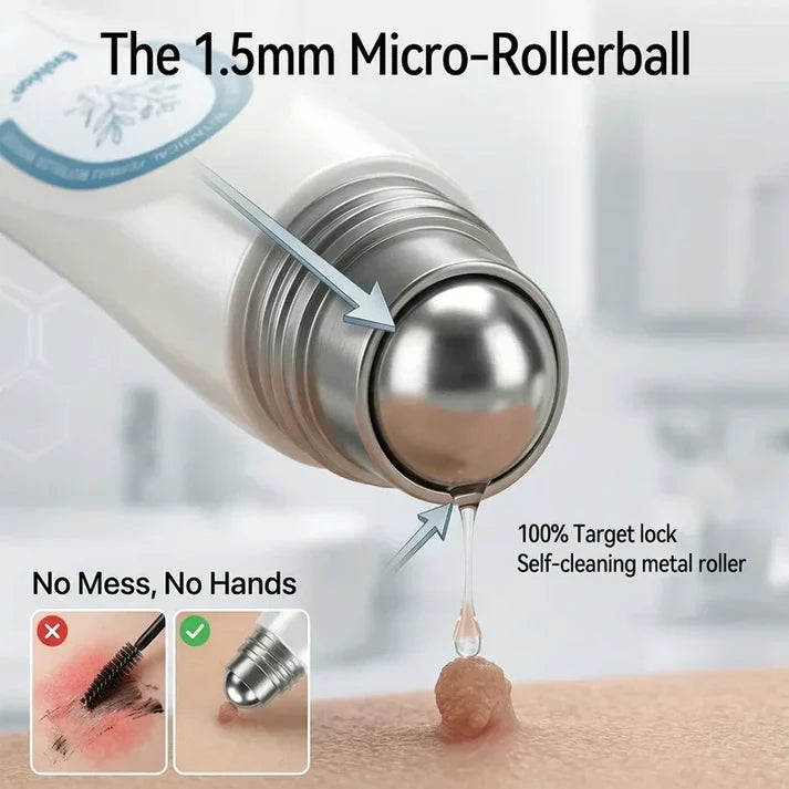 ✨Evolvion® 7-Day Skin Tag & Spot Eraser Painless & Scar-Free Advanced Imperfection RemovaI RoIIerbaII Pen 🌿