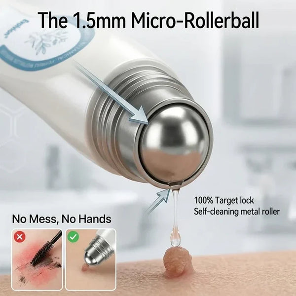 ✨Evolvion® 7-Day Skin Tag & Spot Eraser Painless & Scar-Free Advanced Imperfection RemovaI RoIIerbaII Pen 🌿