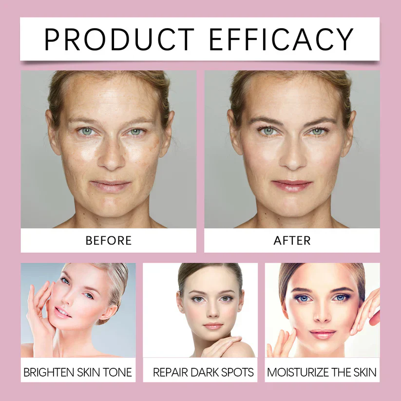 🔥Limited Time Offer🔥Advanced Dark Spot Corrector Serum -Multi-Correction Brightening Formulafor Sun Spots, Age Spots, and Melasma