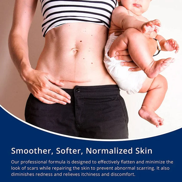 Advanced Silicone Scar Removal Gel