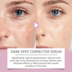 🔥Limited Time Offer🔥Advanced Dark Spot Corrector Serum -Multi-Correction Brightening Formulafor Sun Spots, Age Spots, and Melasma
