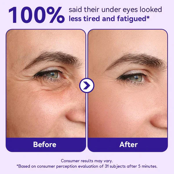 🔥Instant Lift Eye Gel🔥 — For the look of Puffiness & Bags, Wrinkles, Fine Lines and Dark Circles, Anti Aging Skin Care for Men & Women with MaxLift3 Biotech Under Eye Brightener
